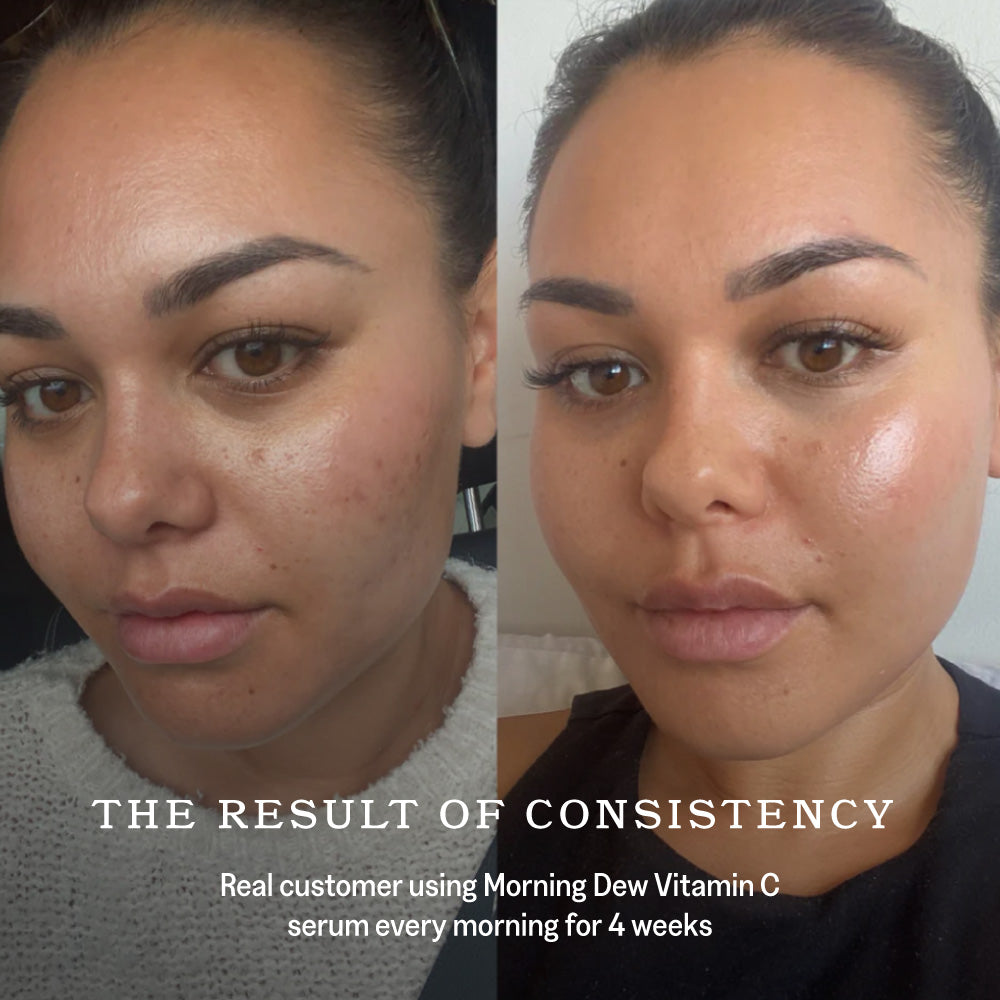 Morning Dew Vitamin C Serum