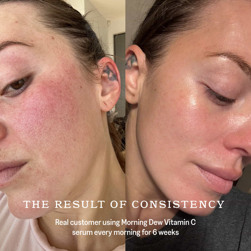 Morning Dew Vitamin C Serum
